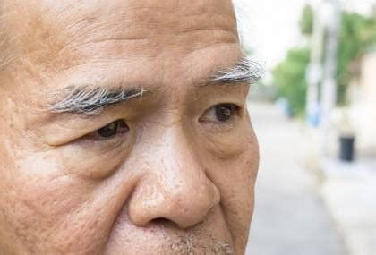 老人眉毛變長|眉毛愈長愈長壽？醫揭真相 50歲後眉毛變長小心「4健康隱憂」